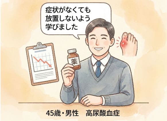 症状がなくても放置しないよう学びました（45歳男性 高尿酸血症）